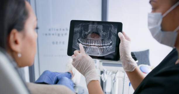 Licensed Dental Implants service in Orland, CA - Smile Center Dentistry