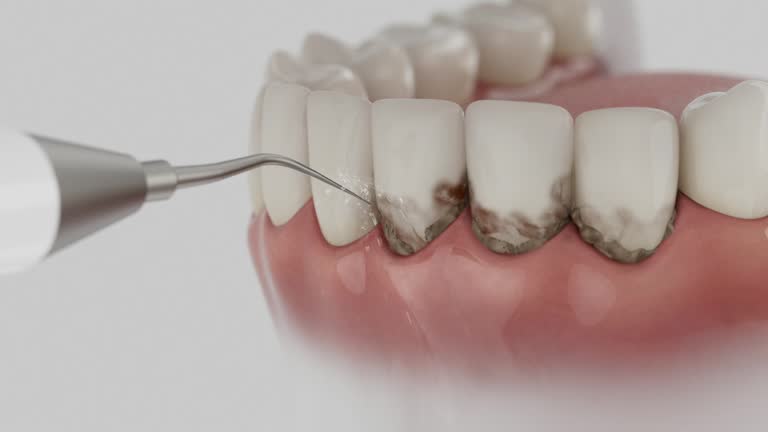 Reliable Dental Implants contractor in Orland, CA by Smile Center Dentistry